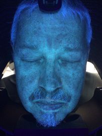 Cilt Tarayıcı Teşhis Makinesi, 3d Uv Cilt Analizi