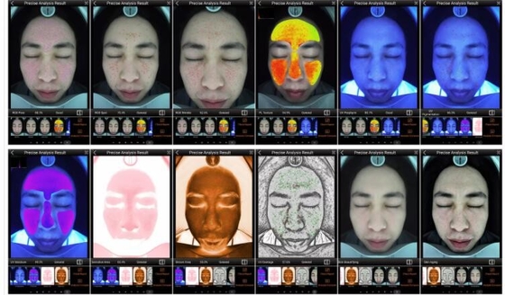 RGB UV PL Akıllı Cilt Analiz Cihazı