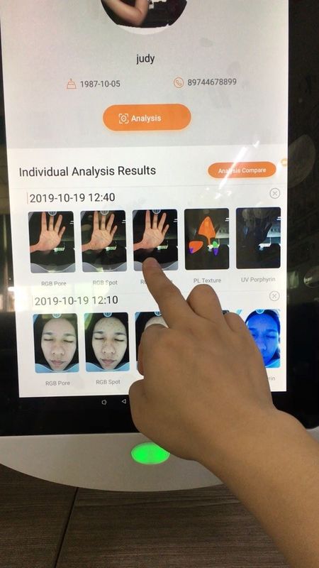 Sihirli Ayna Taşınabilir Cilt Analizörü Sd Kart Doktor Cilt Kliniği Için Kaydet